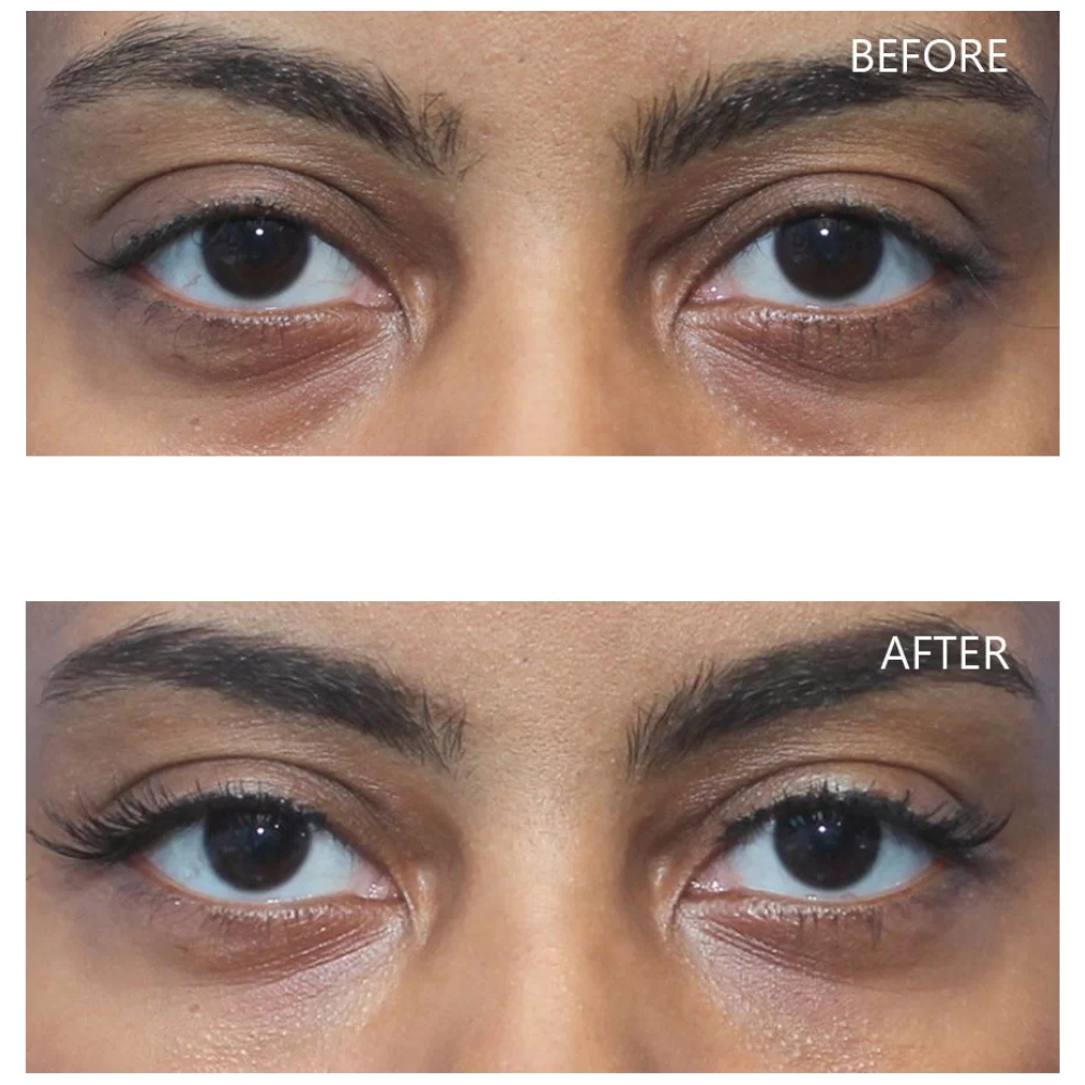 Dr. Melaxin Eyephalt Undereye Cream
