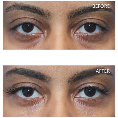 Dr. Melaxin Eyephalt Undereye Cream