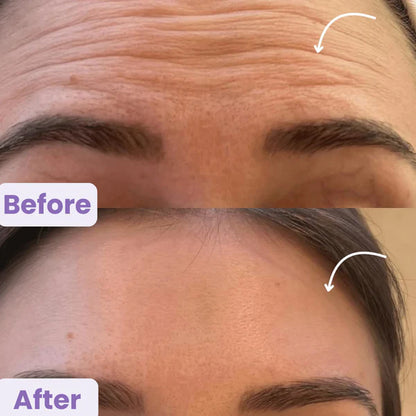 LumiSculpt™ Lymphatic Contour Brush  - Jawline, Chin & Face Depuffing