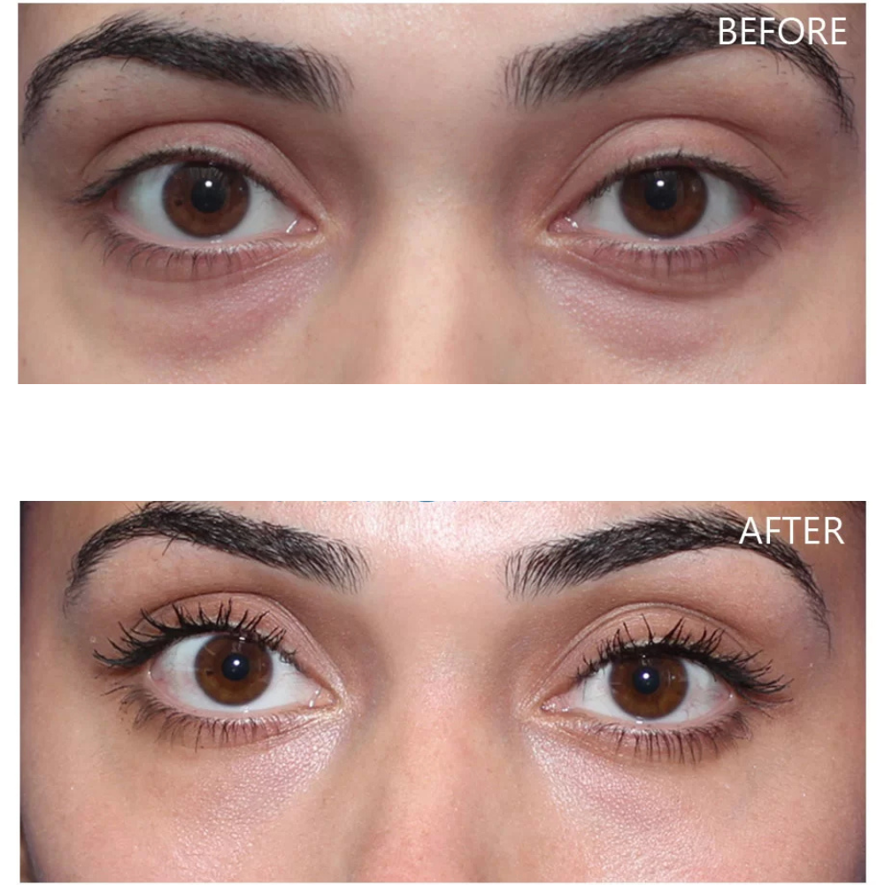 Dr. Melaxin Eyephalt Undereye Cream