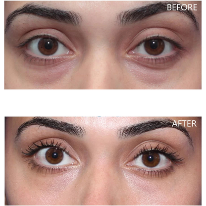 Dr. Melaxin Eyephalt Undereye Cream