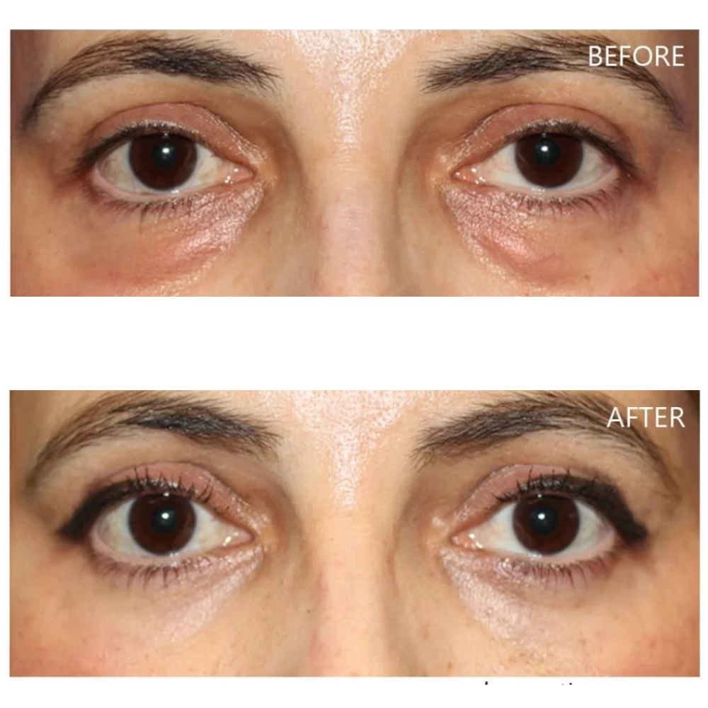 Dr. Melaxin Eyephalt Undereye Cream