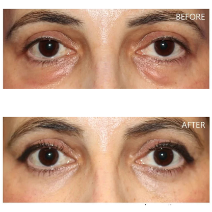 Dr. Melaxin Eyephalt Undereye Cream