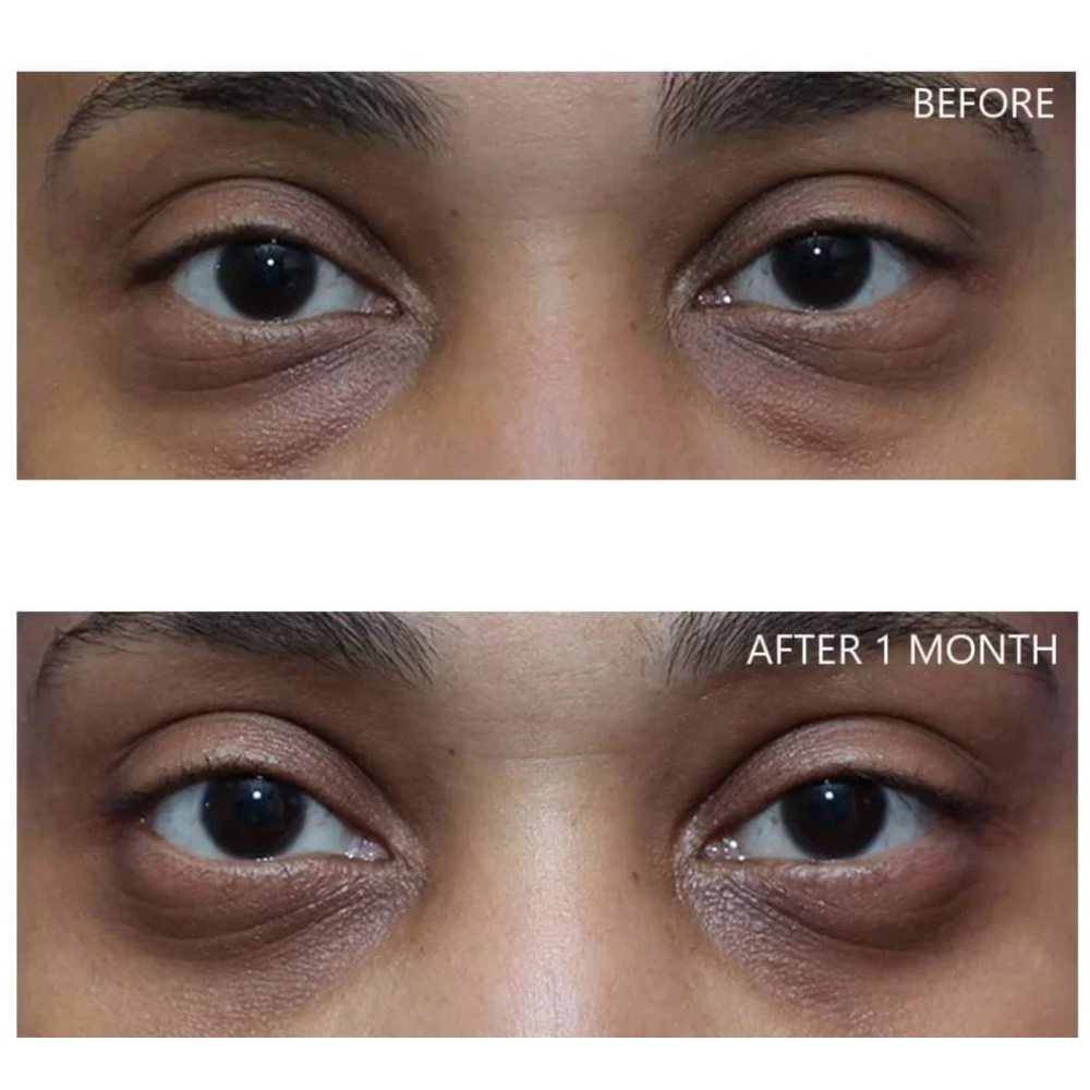 Dr. Melaxin Eyephalt Undereye Cream