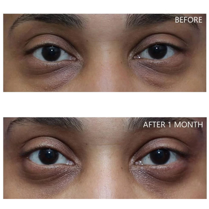 Dr. Melaxin Eyephalt Undereye Cream