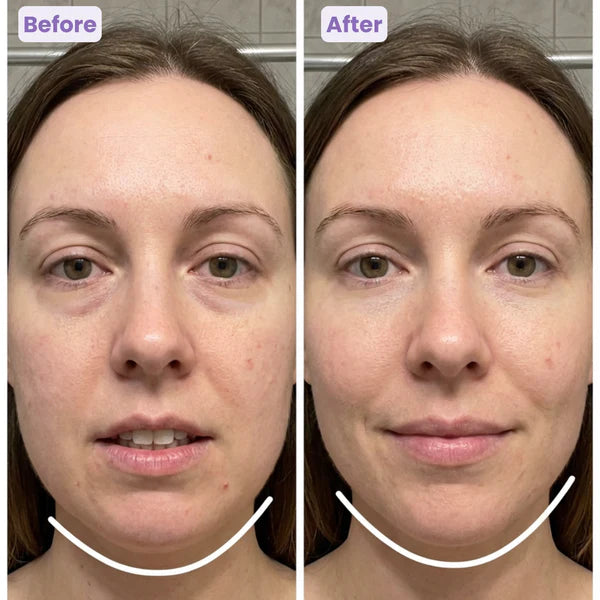 LumiSculpt™ Lymphatic Contour Brush  - Jawline, Chin & Face Depuffing