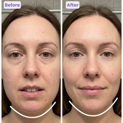 LumiSculpt™ Lymphatic Contour Brush  - Jawline, Chin & Face Depuffing