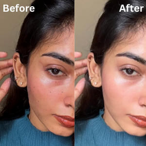 Zilch™ Gold Glow Facial Bar