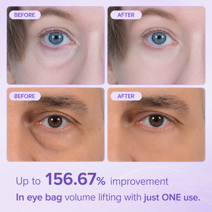 Dr. Melaxin Eyephalt Undereye Cream